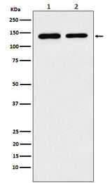Anti-SA2 Rabbit Monoclonal Antibody Boster Bio