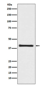 Anti-PRAS40 AKT1S1 Rabbit Monoclonal Antibody Boster Bio