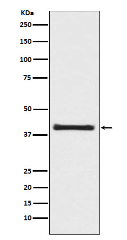 Anti-PRAS40 AKT1S1 Rabbit Monoclonal Antibody Boster Bio