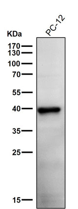 Anti-Phospho-PRAS40 (T246) Rabbit Monoclonal Antibody Boster Bio