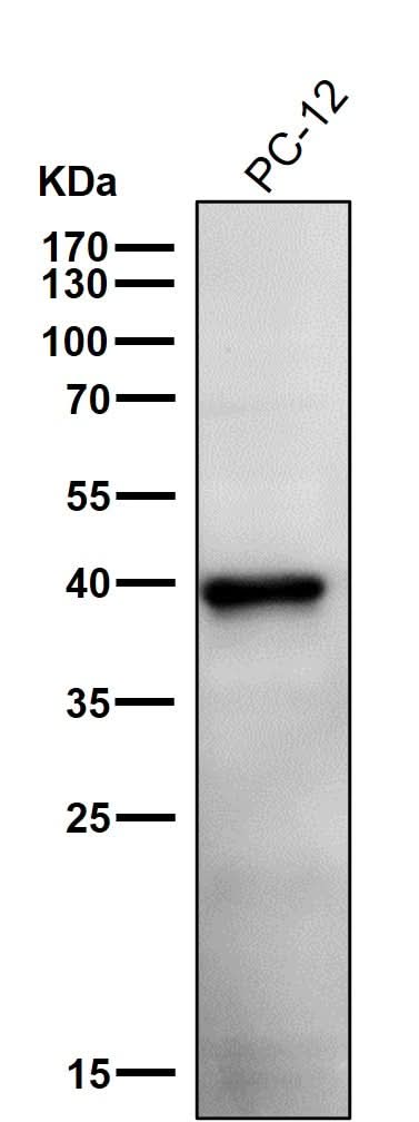 Anti-Phospho-PRAS40 (T246) Rabbit Monoclonal Antibody Boster Bio