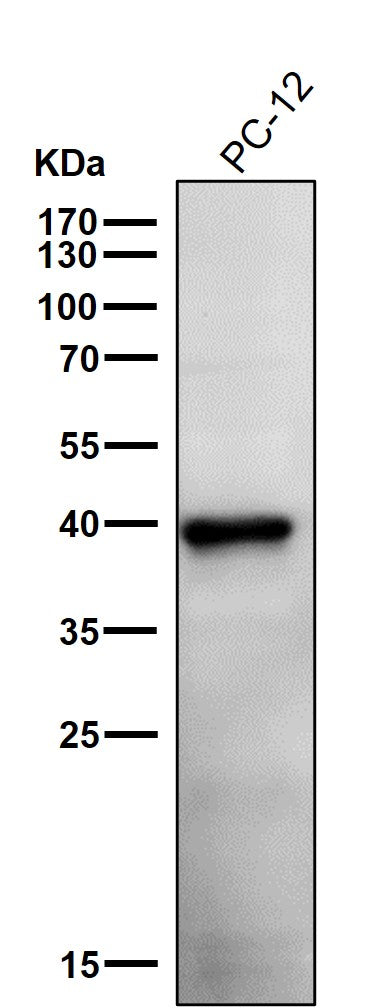 Anti-Phospho-PRAS40 (T246) Rabbit Monoclonal Antibody Boster Bio