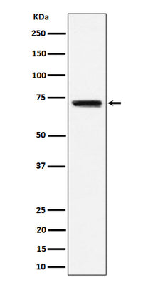 Anti-BLNK Rabbit Monoclonal Antibody Boster Bio