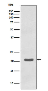 Anti-MTCO2 Rabbit Monoclonal Antibody Boster Bio