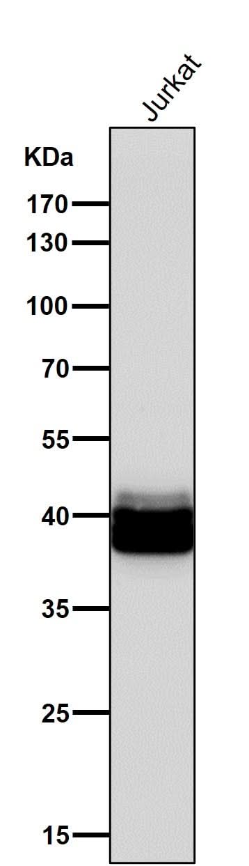 Anti-PAR4 Rabbit Monoclonal Antibody Boster Bio