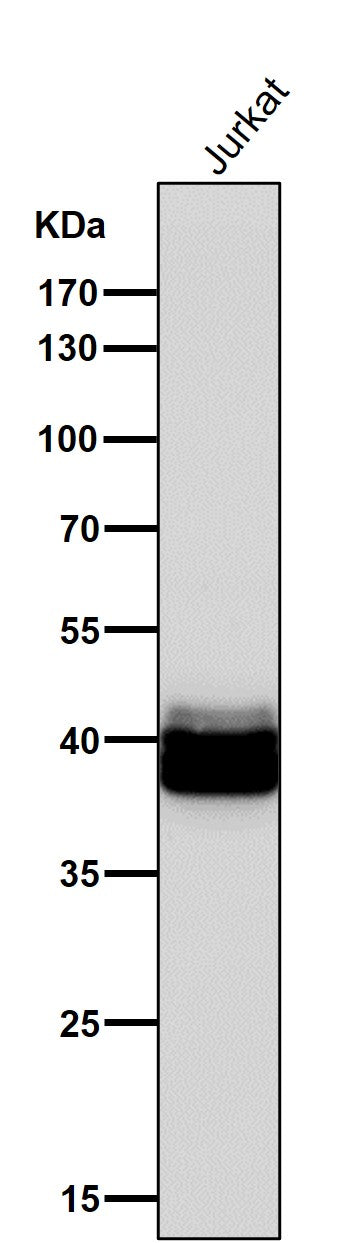 Anti-PAR4 Rabbit Monoclonal Antibody Boster Bio