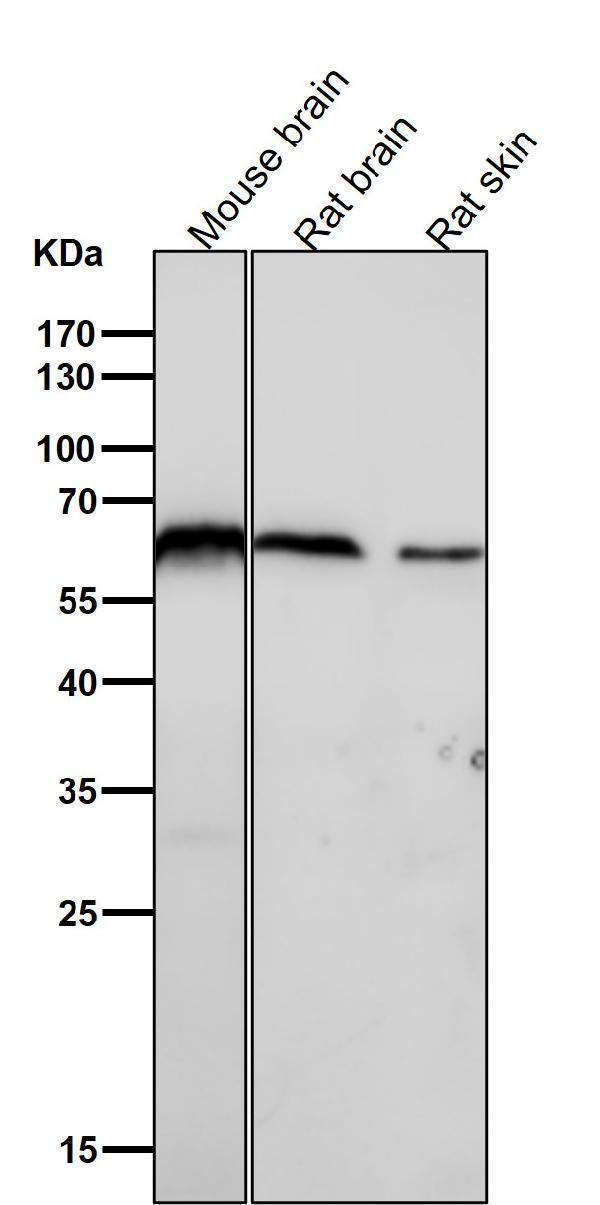 Anti-U2AF65 Rabbit Monoclonal Antibody Boster Bio