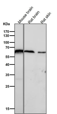 Anti-U2AF65 Rabbit Monoclonal Antibody Boster Bio