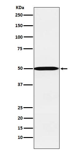 Anti-CYP26A1 Rabbit Monoclonal Antibody Boster Bio