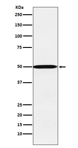 Anti-CYP26A1 Rabbit Monoclonal Antibody Boster Bio