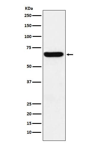 Anti-Methionine Aminopeptidase 2 Rabbit Monoclonal Antibody Boster Bio