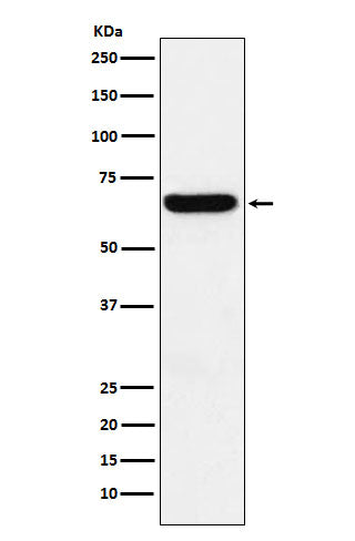 Anti-Methionine Aminopeptidase 2 Rabbit Monoclonal Antibody Boster Bio