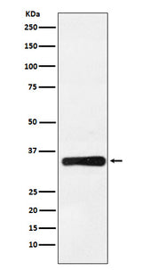 Anti-HOXB4 Rabbit Monoclonal Antibody Boster Bio