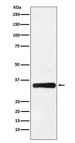 Anti-HOXB4 Rabbit Monoclonal Antibody Boster Bio