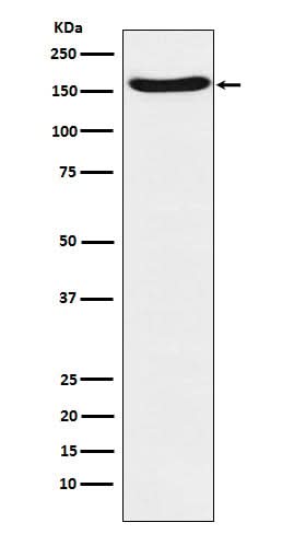 Anti-FANCA Rabbit Monoclonal Antibody Boster Bio