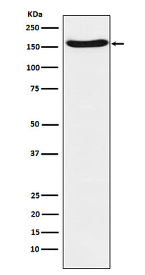 Anti-FANCA Rabbit Monoclonal Antibody Boster Bio