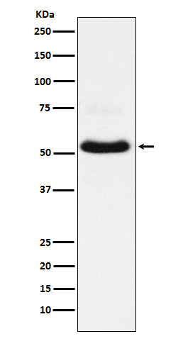 Anti-VGLUT1 Rabbit Monoclonal Antibody Boster Bio