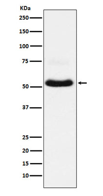 Anti-VGLUT1 Rabbit Monoclonal Antibody Boster Bio