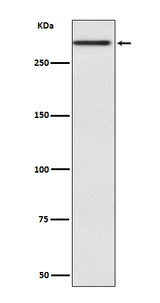 Anti-Cubilin CUBN Rabbit Monoclonal Antibody Boster Bio