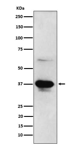 Anti-ICAD Rabbit Monoclonal Antibody Boster Bio