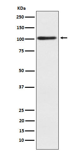 Anti-Alpha actinin 2 Rabbit Monoclonal Antibody Boster Bio