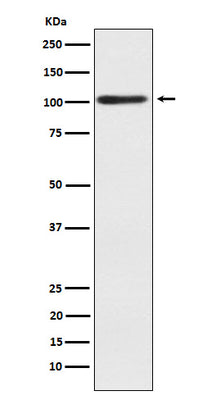 Anti-Alpha actinin 2 Rabbit Monoclonal Antibody Boster Bio