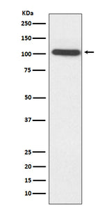 Anti-ACTN2 Rabbit Monoclonal Antibody Boster Bio