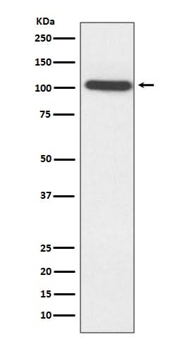 Anti-ACTN2 Rabbit Monoclonal Antibody Boster Bio