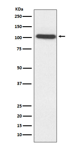 Anti-ACTN2 Rabbit Monoclonal Antibody Boster Bio