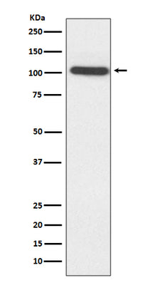 Anti-ACTN2 Rabbit Monoclonal Antibody Boster Bio