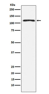 Anti-HLTF Rabbit Monoclonal Antibody Boster Bio