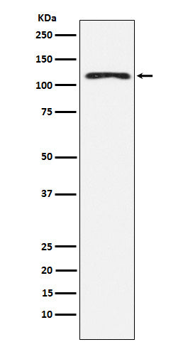 Anti-HLTF Rabbit Monoclonal Antibody Boster Bio