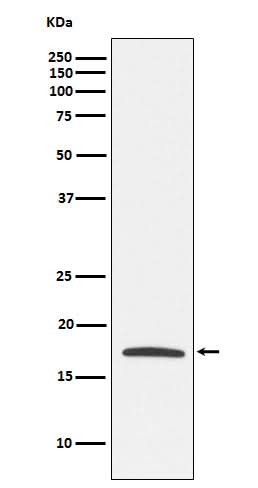 Anti-Claudin 4 Monoclonal Antibody Boster Bio