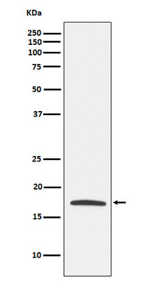 Anti-Claudin 4 Monoclonal Antibody Boster Bio