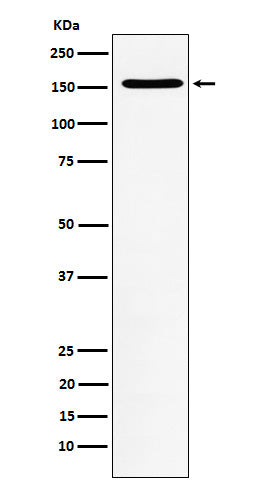 Anti-WAPL Rabbit Monoclonal Antibody Boster Bio