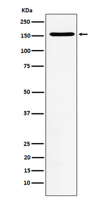 Anti-WAPL Rabbit Monoclonal Antibody Boster Bio