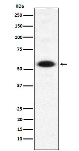 Anti-DMAP1 Rabbit Monoclonal Antibody Boster Bio