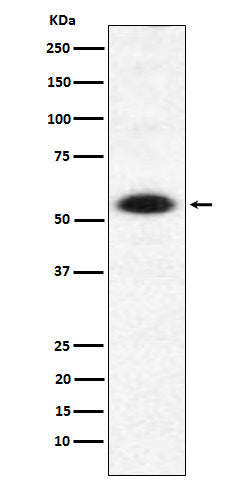 Anti-DMAP1 Rabbit Monoclonal Antibody Boster Bio