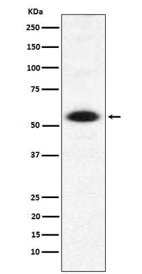 Anti-DMAP1 Rabbit Monoclonal Antibody Boster Bio