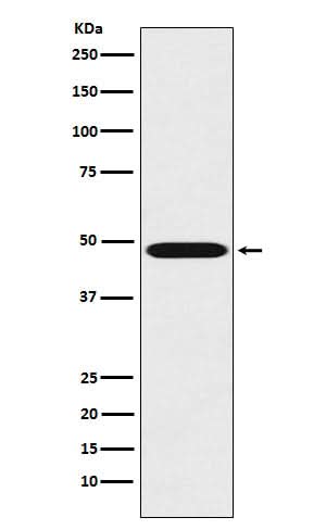 Anti-Renin Rabbit Monoclonal Antibody Boster Bio