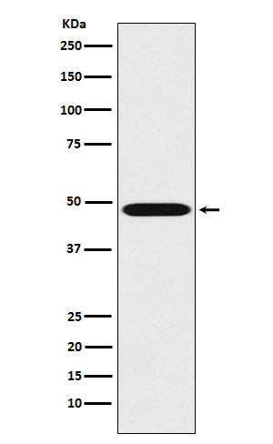 Anti-Renin Rabbit Monoclonal Antibody Boster Bio