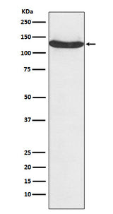 Anti-hnRNP U Monoclonal Antibody Boster Bio