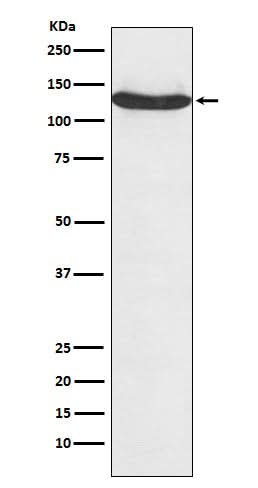 Anti-hnRNP U Monoclonal Antibody Boster Bio