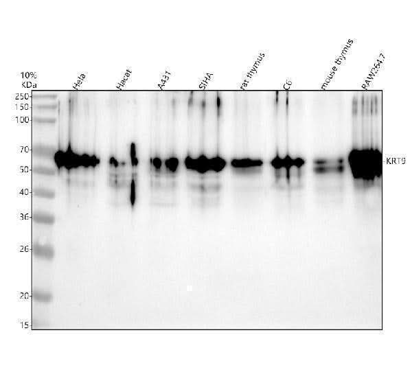 Anti-Cytokeratin 9 KRT9 Rabbit Monoclonal Antibody Boster Bio