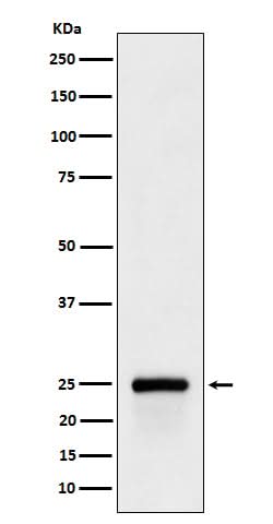 Anti-GSTA4 Rabbit Monoclonal Antibody Boster Bio