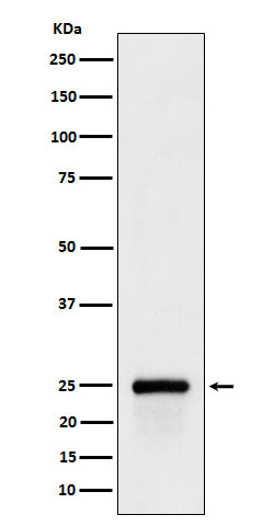 Anti-GSTA4 Rabbit Monoclonal Antibody Boster Bio