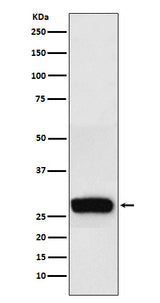 Anti-beta Casein Rabbit Monoclonal Antibody Boster Bio