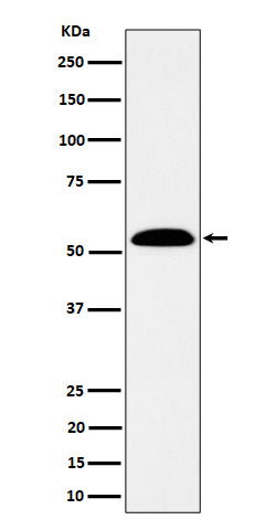 Anti-ALDH7A1 Rabbit Monoclonal Antibody Boster Bio
