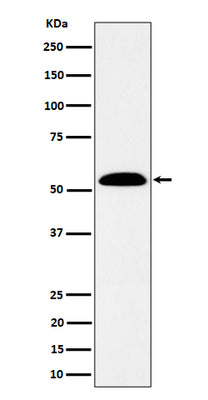 Anti-ALDH7A1 Rabbit Monoclonal Antibody Boster Bio
