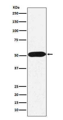 Anti-FKBP38 Rabbit Monoclonal Antibody Boster Bio